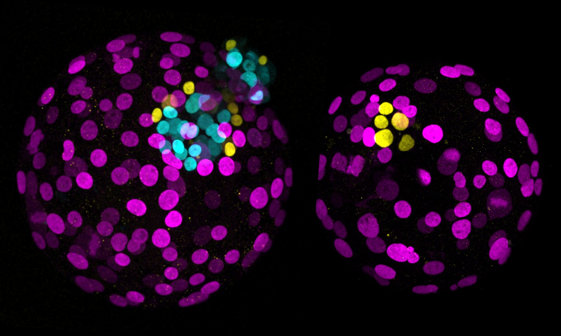 1 - Human base edited vs control_NANOG-03 Day 6 human embryos showing the effect of NANOG presence versus absence, provided compliments of Katarina Harasimov, Oliver Bower and Kathy Niakan, Loke Centre for Trophoblast Research, University of Cambridge.