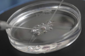 ICSI (Intracytoplasmic Sperm Injection)