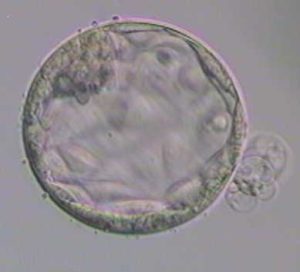 Embryo grading hatching Blastocyst