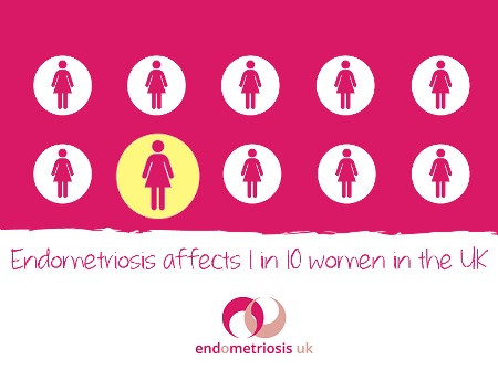 treatment of endometriosis