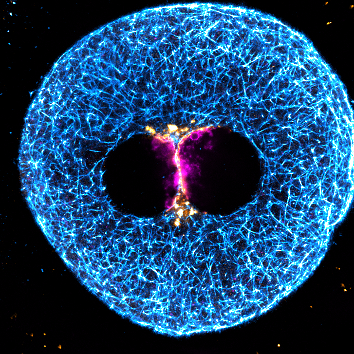 Human zygote embryo grading for IVF